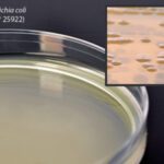 BHI (Brain Heart Infusion) Agar, Hardy Diagnostics - A20, 15 x 100 mm, BHI Agar with 5% Sheep Blood