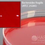 Anaerobic PEA, Hardy Diagnostics - A90, 15x100mm, CDC formula