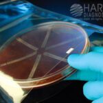 AnaBag 150 Incubation Bags, Hardy Diagnostics - AB20, 150 mm, Anabag 150