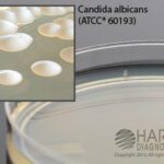 Sabdex (Sabouraud Dextrose) Agar, Hardy Diagnostics - W72, 15x100mm, With Chloramphenicol