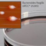 LKV Agar, Reducible, Hardy Diagnostics - A60, 15x100 mm plate, LKV Agar, HDx