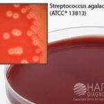 Bovine Selective Strep Agar, Hardy Diagnostics - A143, 15 x 100 mm, Bovine Selective Strep, HDx