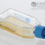 Sabdex (Sabouraud Dextrose) Agar, Hardy Diagnostics - X41, 15x100mm, With Chloramphenicol