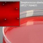 Bovine Blood Agar, 5%, Hardy Diagnostics - A19BX, 15 x 100 mm, Tryptic Soy Agar (TSA) with Blood and 0.1% Esculin