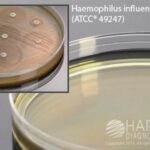 HTM Agar (Haemophilus Test Medium) for susceptibility testing, Hardy Diagnostics - H07, 15 x 150 mm, HTM Agar, Haemophilus Test Medium
