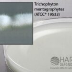 Potato Flake Agar, Hardy Diagnostics - W59, 15×100 mm, Potato Flake Agar