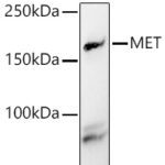 MET Rabbit pAb