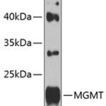 MGMT Rabbit pAb