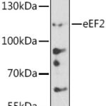 eEF2 Rabbit pAb