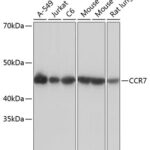 CCR7 Rabbit mAb