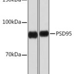 PSD95 Rabbit mAb
