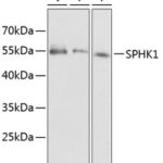 SPHK1 Rabbit pAb