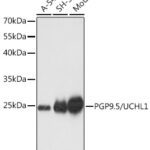 PGP9.5/UCHL1 Rabbit pAb
