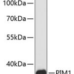 PIM1 Rabbit pAb