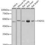 FADS1 Rabbit mAb