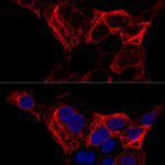 Cytokeratin 20 (KRT20) Rabbit pAb
