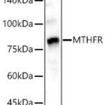 MTHFR Rabbit pAb