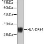 HLA-DRB4 Rabbit mAb