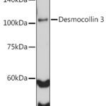 Desmocollin 3 Rabbit mAb